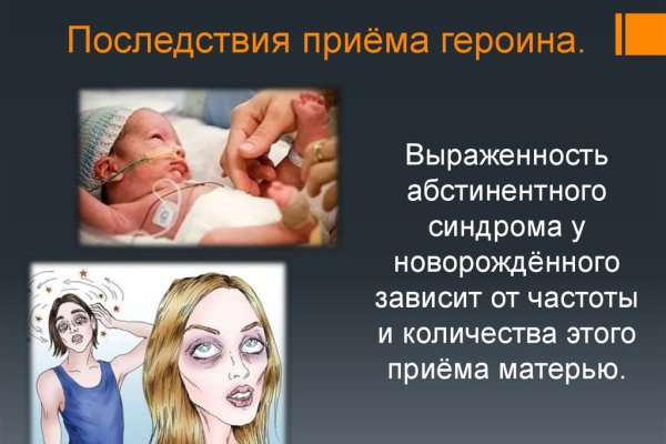 Замена гидры
